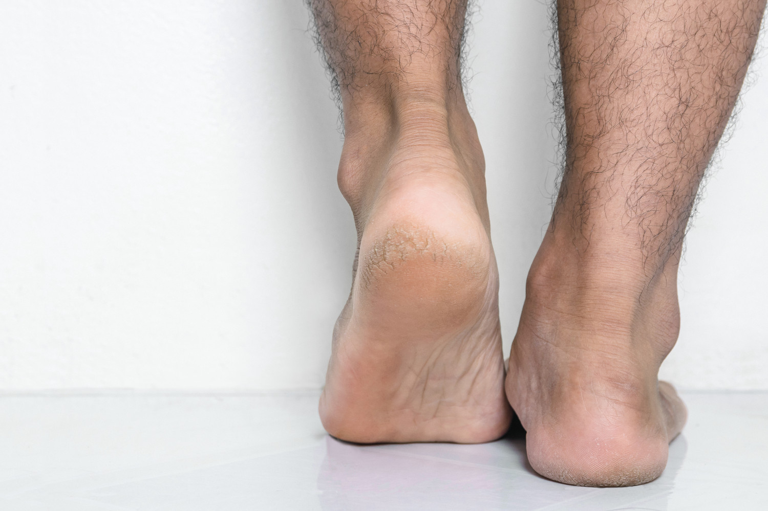 Männerfüße mit starken Schmerzen aus Wolfsburg für eine medizinische Fußbehandlung